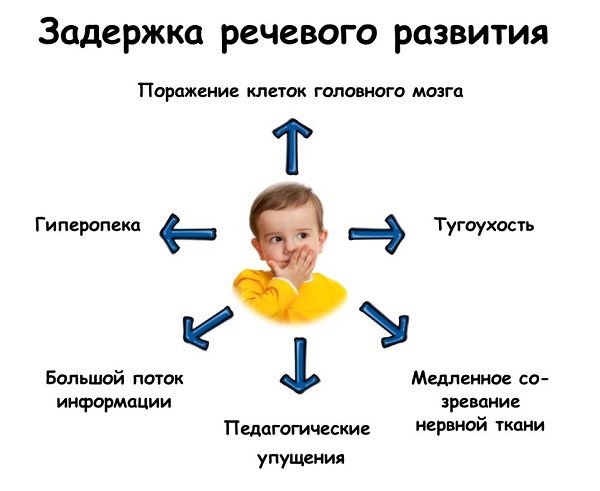 Задержка речевого развития детей